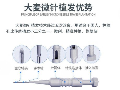 大麦微针植发医院靠谱吗？植发医院8个月前后经历