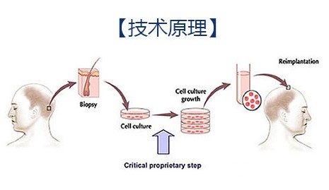 宜昌哪里植发比较好，植发后20天能揉头皮吗?