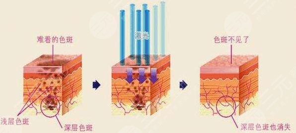 上海美泽医疗美容门诊激光美容怎么样、价格贵吗